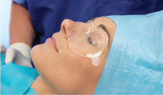 Invotec Swiss Surgical Eye Covers